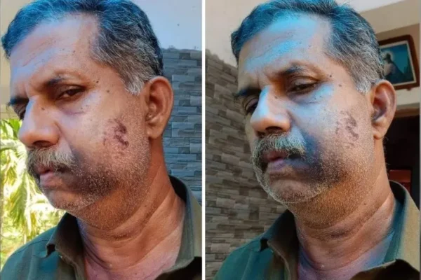 ಬಾಲ್ಯದ ದ್ವೇಷಕ್ಕೆ 50 ವರ್ಷಗಳ ನಂತರ ಸೇಡು: ಕಾಸರಗೋಡಿನಲ್ಲಿ ಇಬ್ಬರು ಬಂಧನ